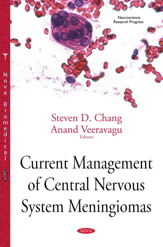 Hassle-Free Returns Current Management of Central Nervous System Meningiomas