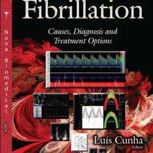 Money Back Guarantee Atrial Fibrillation: Causes, Diagnosis and Treatment Options