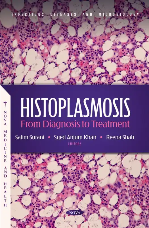 Histoplasmosis: From Diagnosis to Treatment Latest