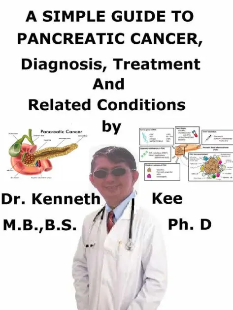 A Simple Guide to Pancreatic Cancer, Diagnosis, Treatment and Related Conditions Deal