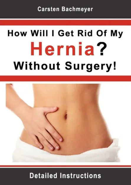 Exclusive How Will I Get Rid Of My Hernia Without Surgery!: Detailed Instructions